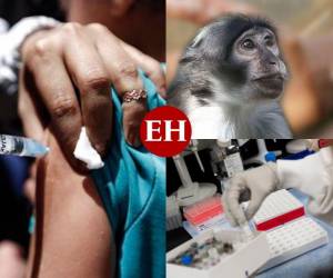 Los contagios de la viruela del mono han sido “más altos de lo esperado”, según reportes de autoridades sanitarias a nivel mundial. Hasta el momento la Organización Mundial de la Salud (OMS) contabiliza más de 80 casos y se encuentra presente en al menos 12 países.