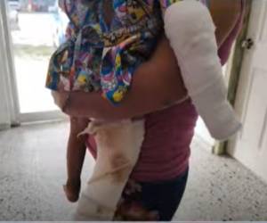 Dipsy Yadira Fernández, madre del menor Liam Adalid Leiva Fernández, denunció públicamente que su entonces compañero de hogar agredió brutalmente a su hijo, causándole quemaduras y fracturas, en un hecho que atribuye a celos.