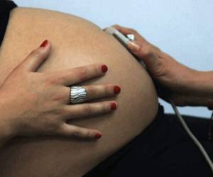 Cifras de la Sesal muestran que a nivel nacional hay al menos 150 mil mujeres en estado de embarazo, esa misma cifra se destinó en inoculantes, pero hasta finales de agosto solo se había vacunado a menos de 30 mil.
