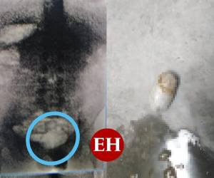 El paquete de droga iba dentro de su recto.