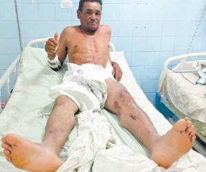 El noble trabajador se recupera en el Hospital Escuela Universitario, afortunadamente no sufrió fracturas que comprometieran órganos vitales. Afirmó que está agradecido con el Creador.