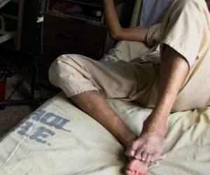 En el 2018 se le amputó el pene en Honduras a 23 hombres. Foto: Archico EL HERALDO