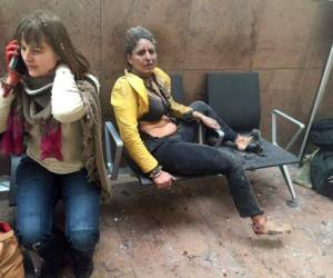 Dos mujeres heridas piden ayuda tras las explosiones - Crédito: AP