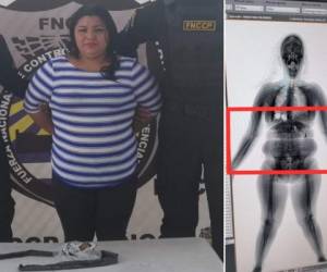 En el escáner se observaba que la mujer llevaba algo extraño dentro del cinturón. Foto: EL HERALDO