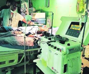 Las personas que sufren de la afección neurológica necesitan ser conectadas a un ventilador artificial para que respiren.