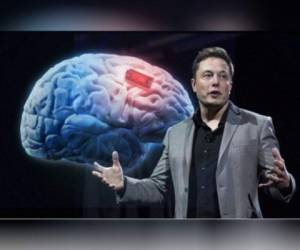 Elon Musk, durante la presentación de 'Neuralink'.