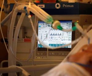 Actualmente, 7,131 personas se encuentran en reanimación, 'un nivel jamás antes alcanzado en Francia', precisó. Foto: AFP.