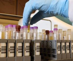 Este protocolo de acuerdo es un paso esencial para garantizar que las dosis se pongan a disposición de todos los países. Foto:AFP