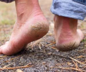 El cuidado de los pies es importante ya que es uno de las partes del cuerpo más utilizadas. Foto: Canva