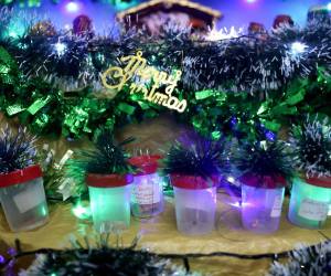 Fotografía que muestra contenedores con piezas dentales extraídas de personas, en un pesebre del área de cirugía del Instituto Nacional de Enfermedades Respiratorias y del Ambiente este martes, en Asunción (Paraguay).