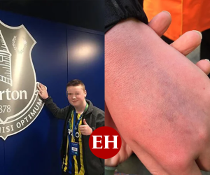 Estas fueron las imágenes que compartió la madre del menor atacado por Ronaldo.