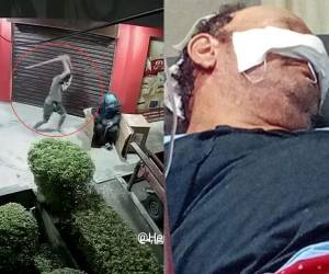 Lamentablemente, un señor de la tercera edad fue atacado por un asaltante en horas de la madrugada de este viernes en La Ceiba.