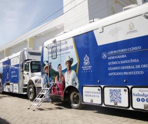 Las Unidades Médicas de Atención Comunitaria en su primera fase atendieron a más de 16,900 pacientes.