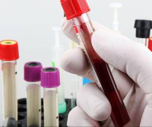 El único laboratorio autorizado para tomar y procesar muestras para detectar el virus del sarampión es el Laboratorio Nacional de Virología.