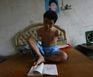 Al no tener brazos, tampoco tiene huellas dactilares, y según el banco eso es algo totalmente necesario. Foto TheJournal.ie