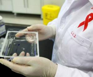 Las terapias retrovirales -a las que tienen acceso en Chile todos los contagiados- hacen que hoy el VIH sea una infección que si bien todavía no es curable es completamente tratable. Foto AFP
