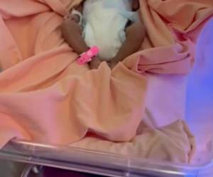 La pequeña ahora podrá continuar su cuidado fuera del hospital tras semanas de tratamiento y observación médica.