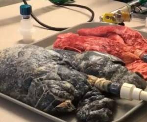 Esta es la comparación que hizo la enfermera Amanda Eller en Facebook, que se ha vuelto viral.