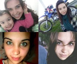 Micaela Cancelo es una joven argentina de 22 años que fue víctima de su novio de una manera salvaje. Según familiares de Micaela, su pareja la roció de aguarrás y le prendió fuego, por lo que hoy se debate entre la vida y la muerte. Foto: Redes Sociales