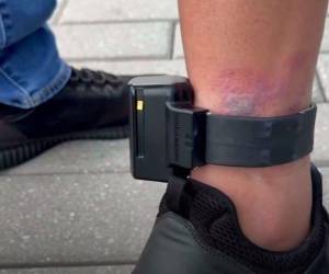 El hondureño agregó que nunca antes había experimentado un nivel de angustia similar y aseguró que su salud emocional se ha deteriorado.