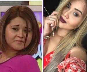 Seguro está pensado que no es la misma persona, pero los es. Ella es 'Gomita' luego de muchas cirugías estéticas ¡claro!