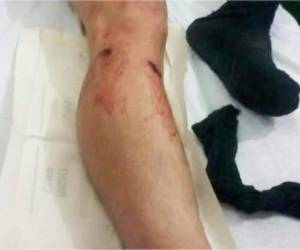 Uno de los militares heridos que fue trasladado al hospital de Trujillo.