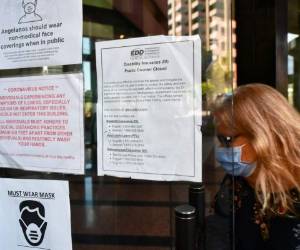 El procedimiento, que es voluntario, se aplica en promedio a unas 40-45 personas diarias en este centro en Torrance, un suburbio a media hora de la ciudad. Cuesta 149 dólares, que cubren algunos seguros médicos. Foto: AFP.