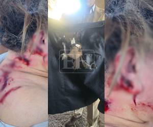 La diputada al Parlamento Centroamericano (Parlacen), Gladys Aurora López, resultó con heridas de consideración luego del atentado ocurrido en las instalaciones del Congreso Nacional.