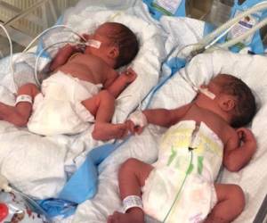 Los gemelos Lenny y Moishe que nacieron a las 32 semanas permanecen bajo el cuidado de su madre subrogada.