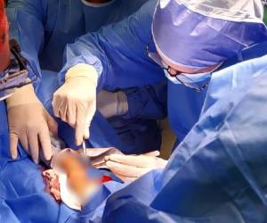 El personal médico engargado de la jornada aseguró que las cirugías buscan mejorar la movilidad, funcionalidad y calidad de vida de los pacientes involucrados en la actividad.