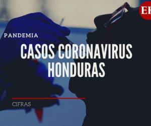 Los días pasan y el mundo urge por la cura para detener la que está catalogada como una de las peores pandemias de la historia.