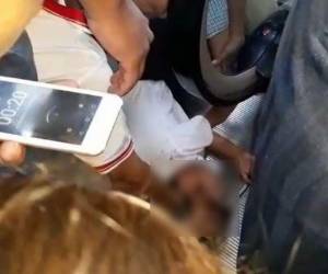 Al parecer el menor estaba bajo la vigilancia de un tío en ese momento y fueron los gritos de dolor los que alertaron lo que sucedía.