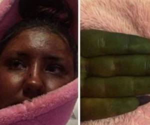 La joven quedó completamente verde al utilizar el autobronceador y por el momento disfruta su curiosa fama. (Foto: Infobae)