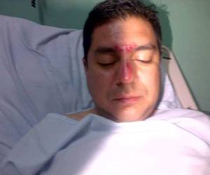 El director de Casa Alianza, José Rúelas García denunció la supuesta agresión policial y aseguró que no conducía bajo los efectos del alcohol. (Foto: Estalin Irías)