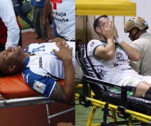 Estas son las lesiones más impactantes que se han dado en partidos de fútbol en Honduras.