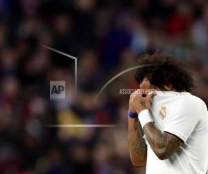 Como suele ser habitual, el club 'merengue' no precisa el plazo de recuperación, limitándose a afirmar que está 'pendiente de evolución'. (Foto: AP)