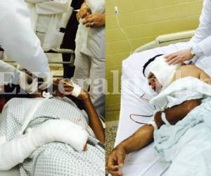 Tanto María Rosa García como Santos Bienvenido Martínez Servellón están recibiendo atención médica en el Hospital Escuela Universitario por las lesiones que sufrieron a consecuencia de las lluvias, foto: El Heraldo/Noticias de Honduras/Sucesos de Honduras/El Heraldo Honduras.