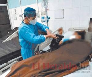 La mujer llegó con complicaciones respiratorias al Hospital de Atlántida. Foto ilustrativa.