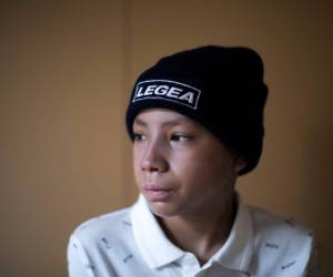 La foto del 21 de febrero de 2019 muestra a Jesús Acosta, de 12 años, en un hotel en Barcelona, donde se encuentra la espera de un transplante de médula ósea y el tratamiento posterior. El tratamiento médico de Jesús iba a ser financiado por la Fundación Simón Bolívar con sede en Houston, Texas, pero él y al menos otros ocho niños venezolanos gravemente enfermos son víctimas involuntarias de las sanciones estadounidenses a Venezuela. (AP Foto/Emilio Morenatti)