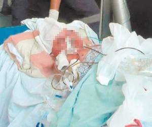 Un niño originario de Copán se encuentra en estado delicado tras ser víctima del estallido de un mortero en su abdomen.