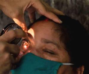 La mayoría de las personas afectadas por hongo negro son del sexo femenino.