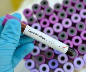 95 hondureño han ido confirmados con coronavirus hasta la fecha, dos de los pacientes han fallecido.