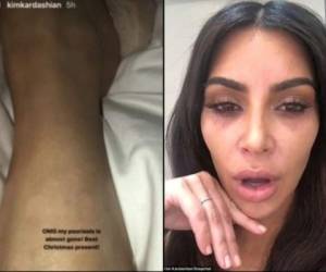 Kim Kardashian tiene varias semanas de mostrar su preocupación por la enfermedad que padece. Fotos captura Snapchat