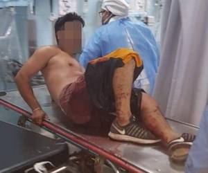 El herido fue identificado como José González. Foto: Policía Nacional.