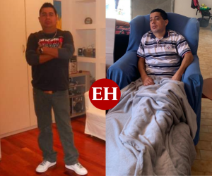 Denis Aarón Cruz Valladares antes y después del lamentable incidente que agravó su estado de salud.