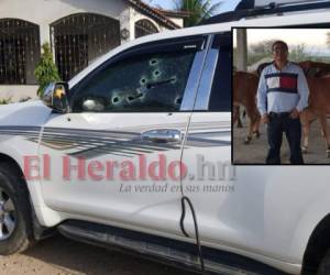 Olman Osorio fue ingresado de emergencia a un hospital privado de Choluteca. Foto: Cortesía.