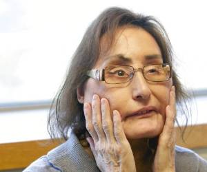 Culp tuvo 30 cirugías antes de someterse a una cirugía de trasplante en 2008 en la Cleveland Clinic, un procedimiento intensamente complejo que tomó 22 horas durante dos días. Foto: AP.