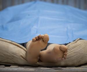 El aire que se respira este viernes en las zonas de desastre del estado costero de La Guaira en Venezuela ya comienza a oler a putrefacción, producto de los cadáveres que aún permanecen sepultados entre los escombros de los edificios colapsados.