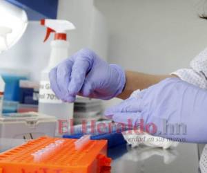 Con equipo de protección e insumos fueron abastecidos algunos hospitales para enfrentar los casos de coronavirus (Covid-19) que ocurran en el país. Foto archivo EL HERALDO