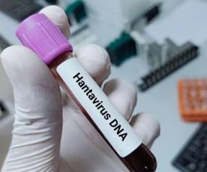 Ante el avance de casos de hantavirus en América, expertos advierten que Honduras debe intensificar la vigilancia epidemiológica para prevenir su ingreso.